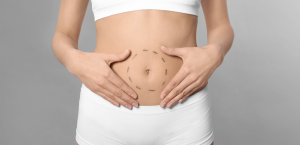 Mini Tummy Tuck Best Prices Near Fairfax VA